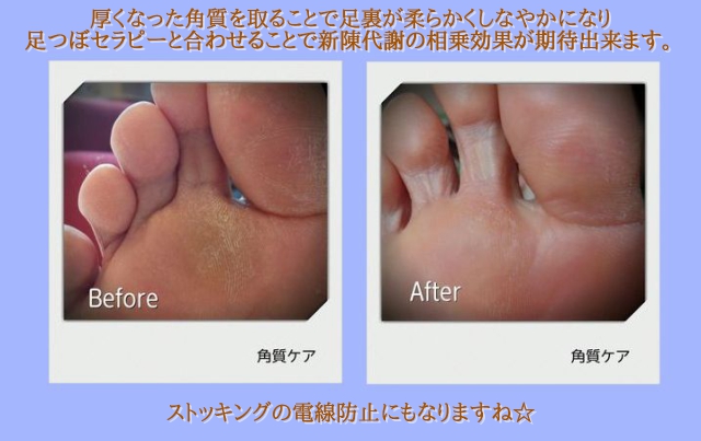新メニュー「角質ケア」登場